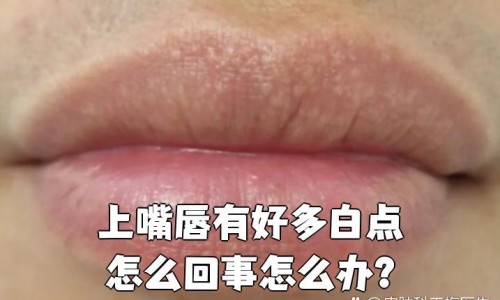 月经期间要少吃哪些水果和蔬菜-月经期间要少吃哪些水果网- 月经期间不适合吃什么水果知识,分享月经期间要少吃哪些水果好